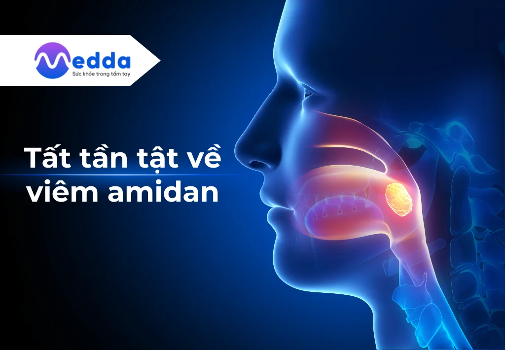 Tất tần tật về viêm amidan: Khi nào cần phẫu thuật cắt amidan?